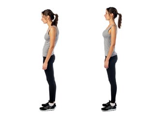 posture alignment • postural restoration physical therapy