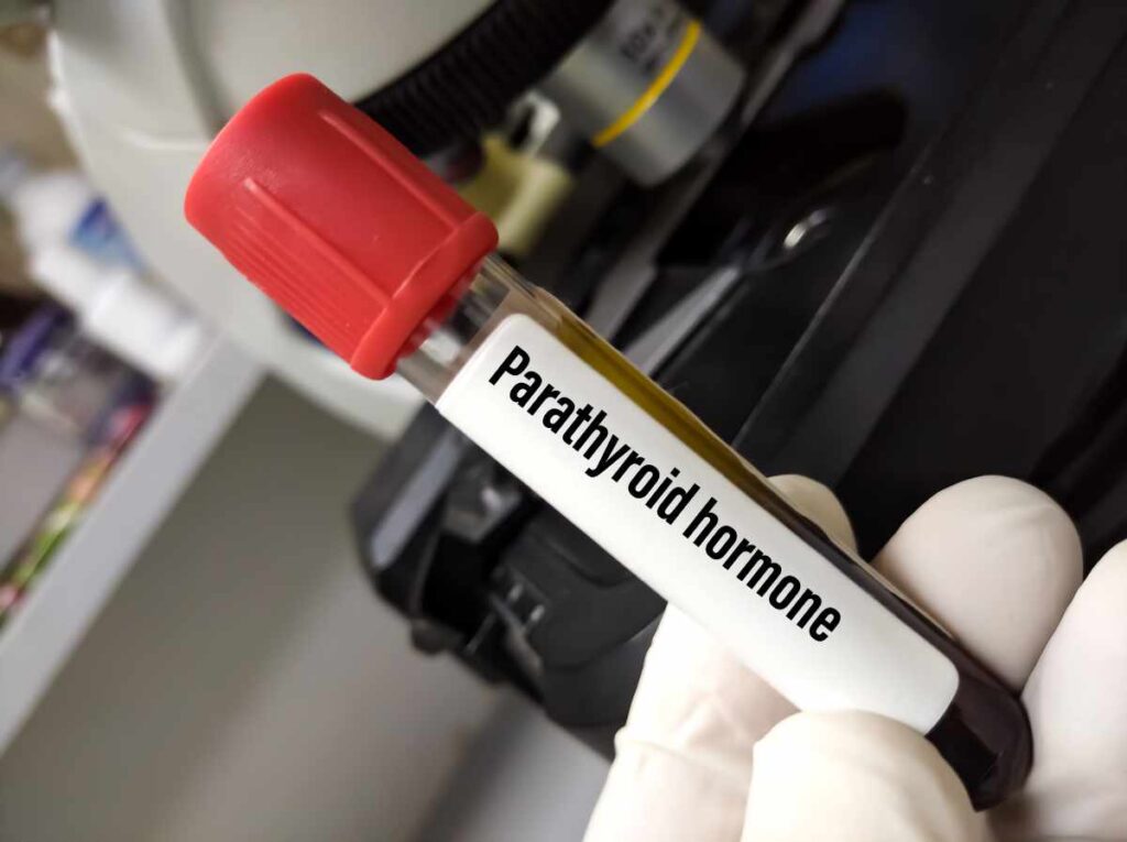 pth and osteoporosis exercise