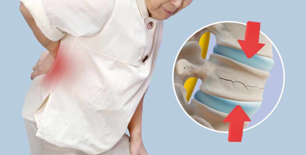 spinal compression fracture therapy