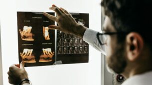 osteonecrosis of the jaw