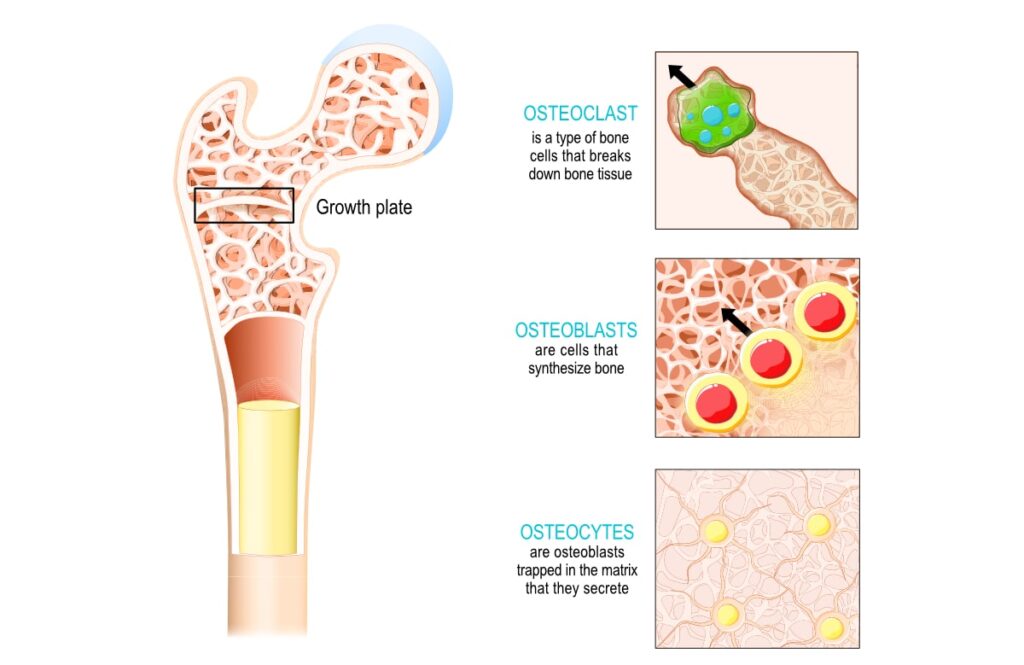 bone remodeling process. MelioGuide