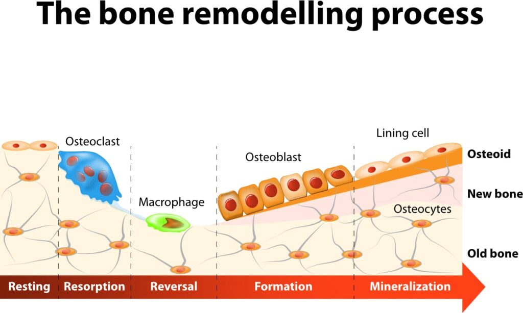 what is bone remodeling? MelioGuide