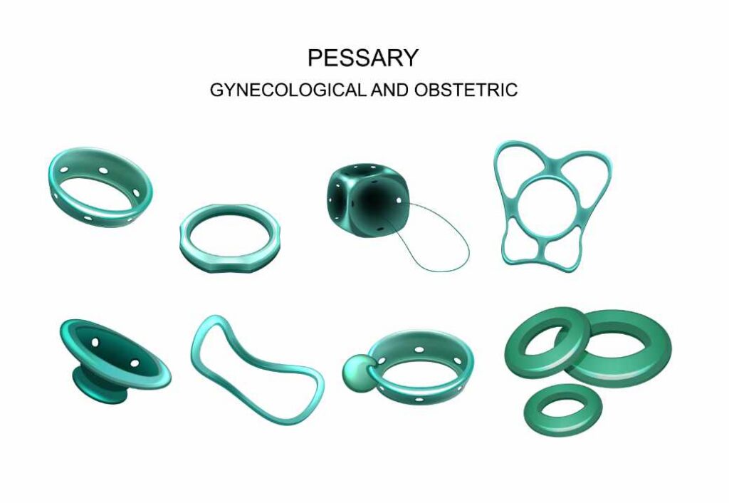 pessary
